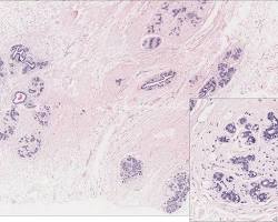 Histopathology scan