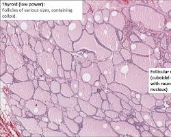 Endocrine tissue